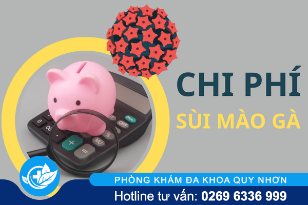 Xác định chi phí khám và điều trị sùi mào gà