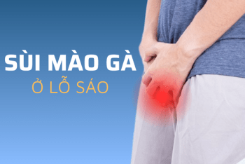 Sùi mào gà ở lỗ sáo mất thẩm mỹ và cực nguy hiểm