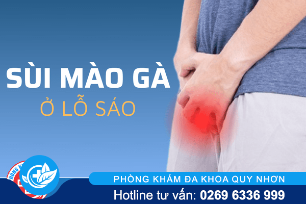 Sùi mào gà ở lỗ sáo mất thẩm mỹ và cực nguy hiểm