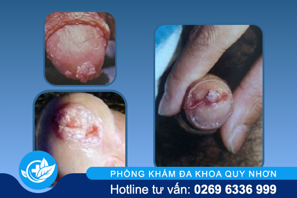 sui-mao-ga-o-lo-sao-mat-tham-my-va-cuc-nguy-hiem-1