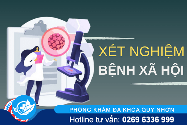 Xét nghiệm bệnh xã hội – Cách giải đáp nghi ngờ toàn diện