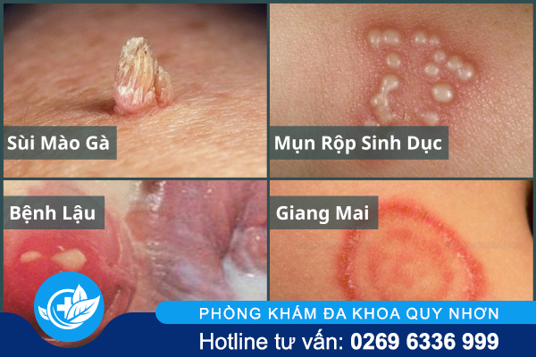 xet-nghiem-benh-xa-hoi-cach-giai-dap-nghi-ngo-toan-dien-3