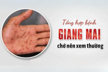 Tổng hợp bệnh giang mai chớ nên xem thường