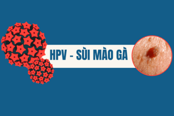 Sùi mào gà có tự khỏi được không?