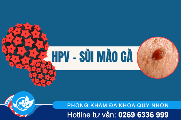 Sùi mào gà có tự khỏi được không?