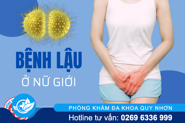 Bệnh lậu ở nữ giới – triệu chứng dễ nhầm lẫn bệnh phụ khoa