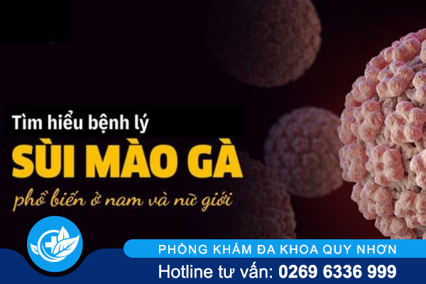 Cần lưu ý với căn bệnh sùi mào gà ở nam và nữ giới