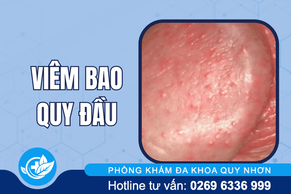 hinh-anh-mun-moc-o-vung-kin-nu-va-nam-gioi-7