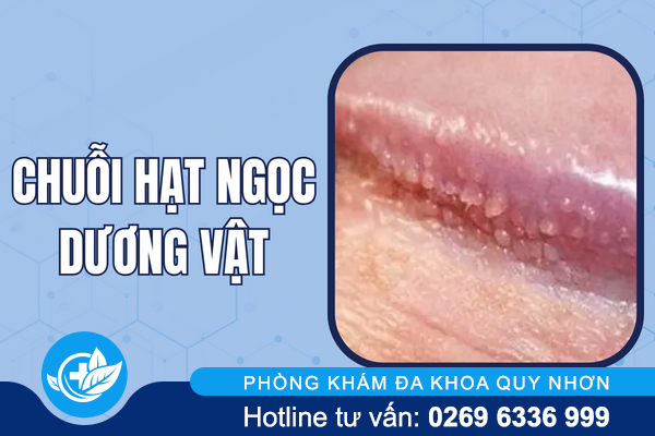 hinh-anh-mun-moc-o-vung-kin-nu-va-nam-gioi-9