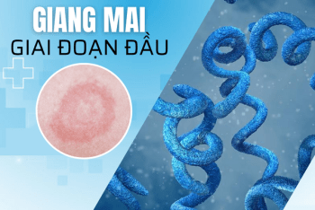 Nhận biết hình ảnh giang mai giai đoạn đầu.