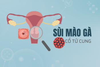 Sùi mào gà cổ tử cung – Khó nhận biết và nguy hiểm khôn lường