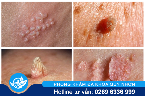 sui-mao-ga-co-ngua-khong-2