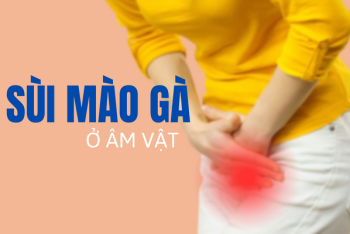 Sùi mào gà ở âm đạo – Từ mất thẩm mỹ đến đe dọa sức khỏe