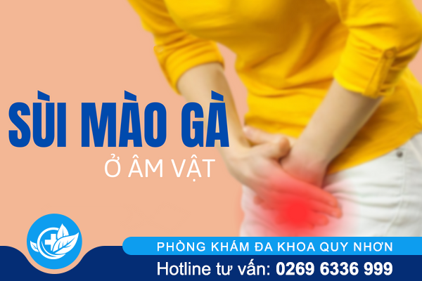 Sùi mào gà ở âm đạo – Từ mất thẩm mỹ đến đe dọa sức khỏe