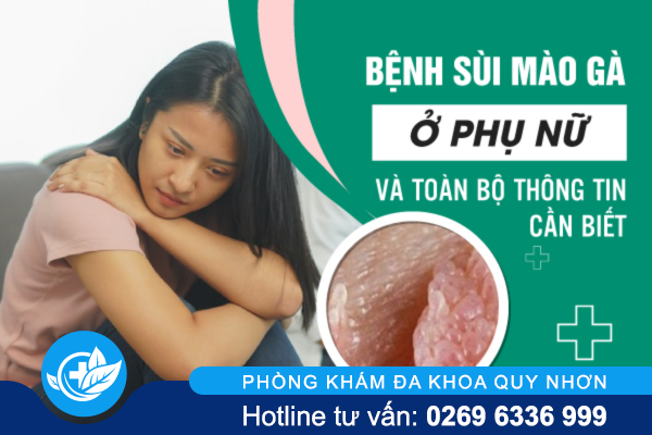 Bệnh sùi mào gà ở phụ nữ và toàn bộ thông tin cần biết