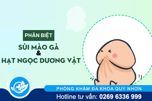 Những tiêu chí phân biệt sùi mào gà và hạt ngọc dương vật