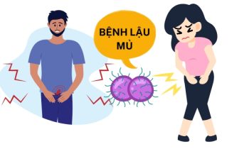 Dấu hiệu bệnh lậu mủ tác hại và cách điều trị