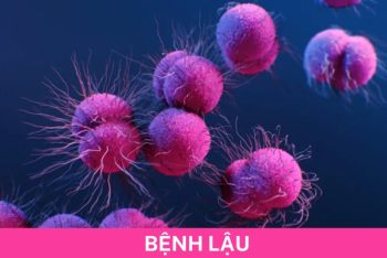 Thông tin về bệnh lậu