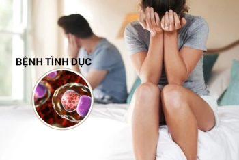 Cảnh giác với bệnh tình dục – bảo vệ sức khỏe bạn từ hôm nay