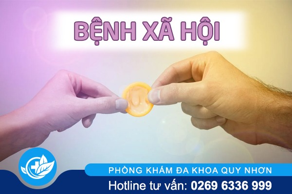 Nguyên nhân bệnh xã hội thường gặp