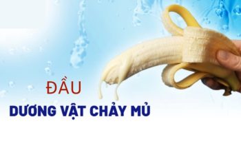 Đầu dương vật chảy mủ là bị bệnh gì nguy hiểm không?