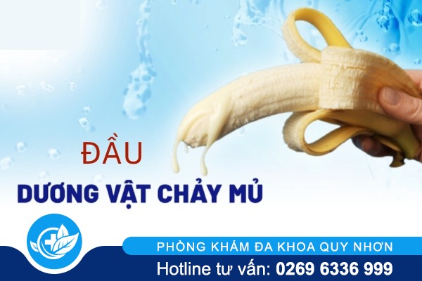Đầu dương vật chảy mủ là bị bệnh gì nguy hiểm không?