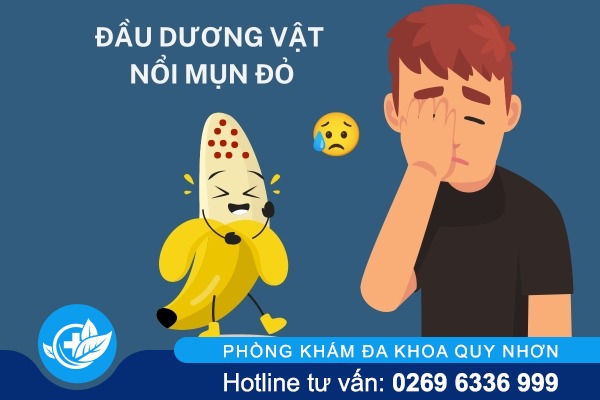 Đầu dương vật nổi mụn đỏ nguyên nhân và cách xử lý