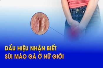 Dấu hiệu bệnh sùi mào gà dễ nhận ra sớm