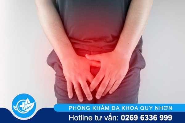 Cách chữa gai sinh dục hiệu quả an toàn