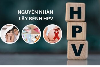 Khám HPV ở đâu uy tín, chi phí thấp?