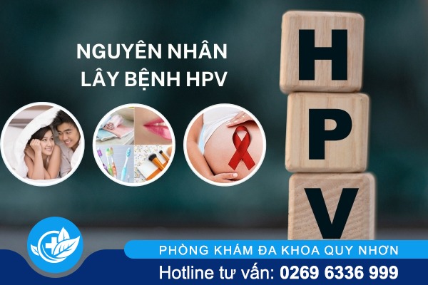 Khám HPV ở đâu uy tín, chi phí thấp?