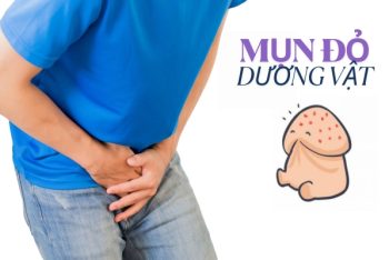 Mụn đỏ dương vật là dấu hiệu bệnh gì?