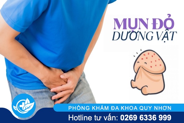 Mụn đỏ dương vật là dấu hiệu bệnh gì?