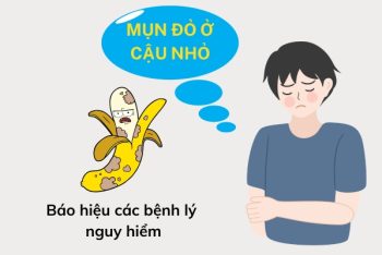 Mụn đỏ ở cậu nhỏ là dấu hiệu bệnh gì?
