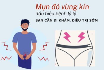 Mụn đỏ vùng kín cảnh báo nhiều bệnh lý đáng lo ngại