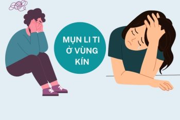 Mụn li ti vùng kín có phải là dấu hiệu bệnh nguy hiểm?