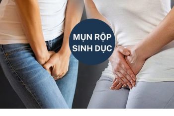 Nguyên nhân mụn rộp sinh dục thường gặp