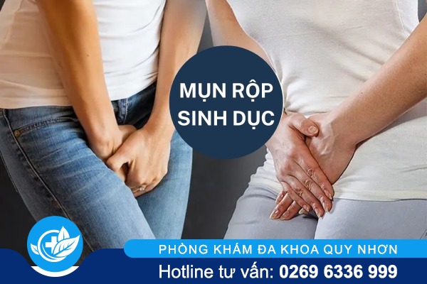 Nguyên nhân mụn rộp sinh dục thường gặp