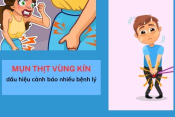 Mụn thịt vùng kín cảnh báo bệnh gì?
