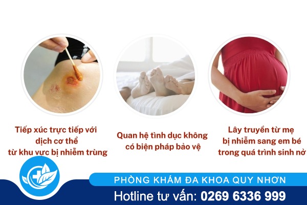 Hiểu đúng nguyên nhân mắc bệnh lậu để bảo vệ bản thân