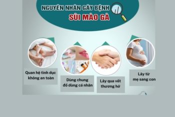 Nguyên nhân sùi mào gà ai cũng cần biết