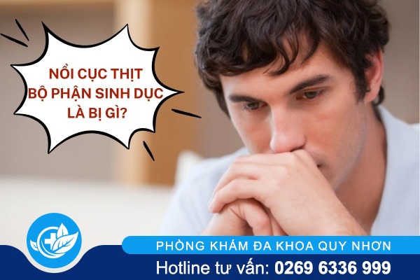 Nổi cục thịt ở bộ phận sinh dục
