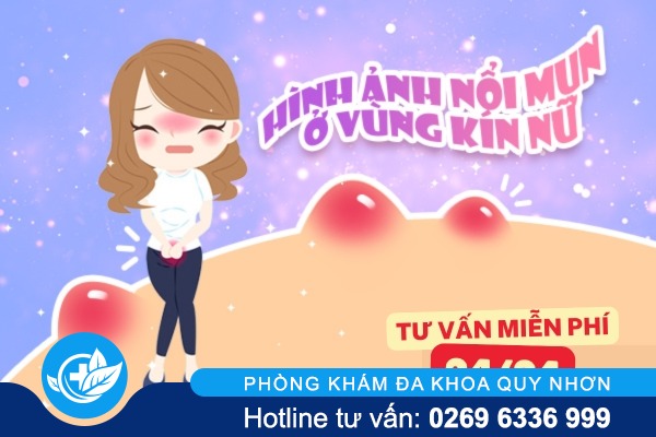 Nổi mụn trắng âm đạo dấu hiệu bình thường hay do bệnh lý?