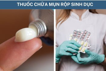 Thuốc chữa mụn rộp sinh dục hiệu quả