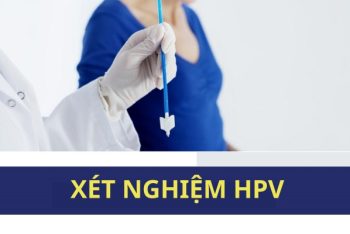 Phương pháp xét nghiệm bệnh HPV nhanh chóng, chính xác