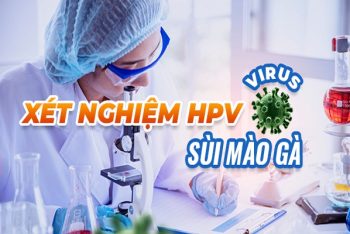 Chi phí xét nghiệm sùi mào gà hiện nay bao nhiêu?