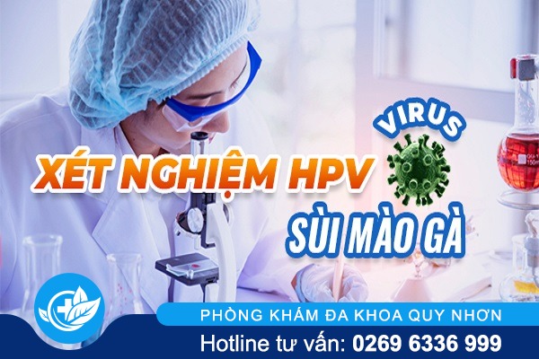 Chi phí xét nghiệm sùi mào gà hiện nay bao nhiêu?