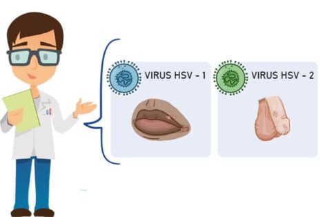 Mụn Rộp Sinh Dục: Hiểu Đúng Để Phòng Ngừa Hiệu Quả
