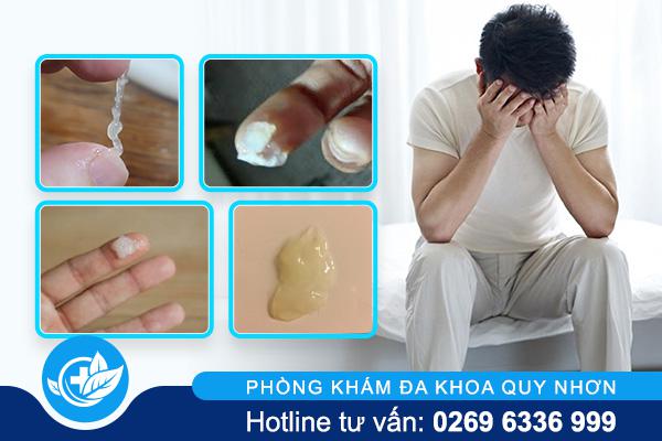 Tinh trùng vón cục: Dấu hiệu cảnh báo vấn đề sức khỏe sinh sản