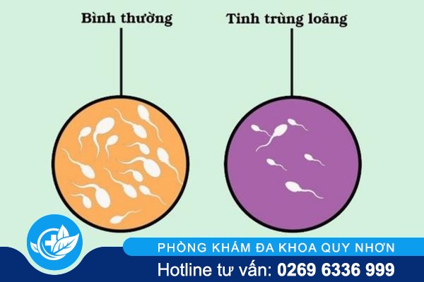 Tinh Trùng Loãng Có Nguy Hiểm Không? Những Điều Nam Giới Cần Biết